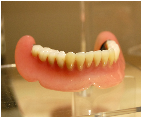 ワコ歯科・矯正歯科の入れ歯作製