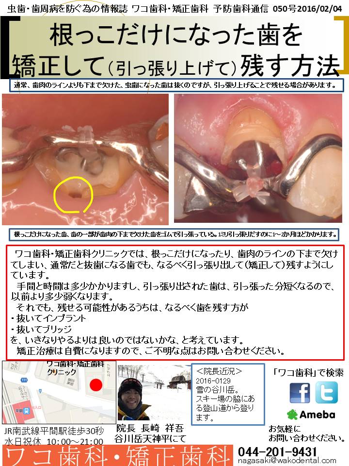 予防歯科通信50(2016年2月4日号)