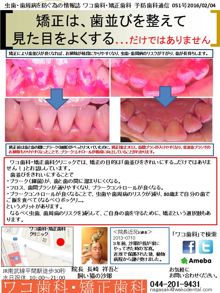 予防歯科通信52(2016年2月4日 no2号)