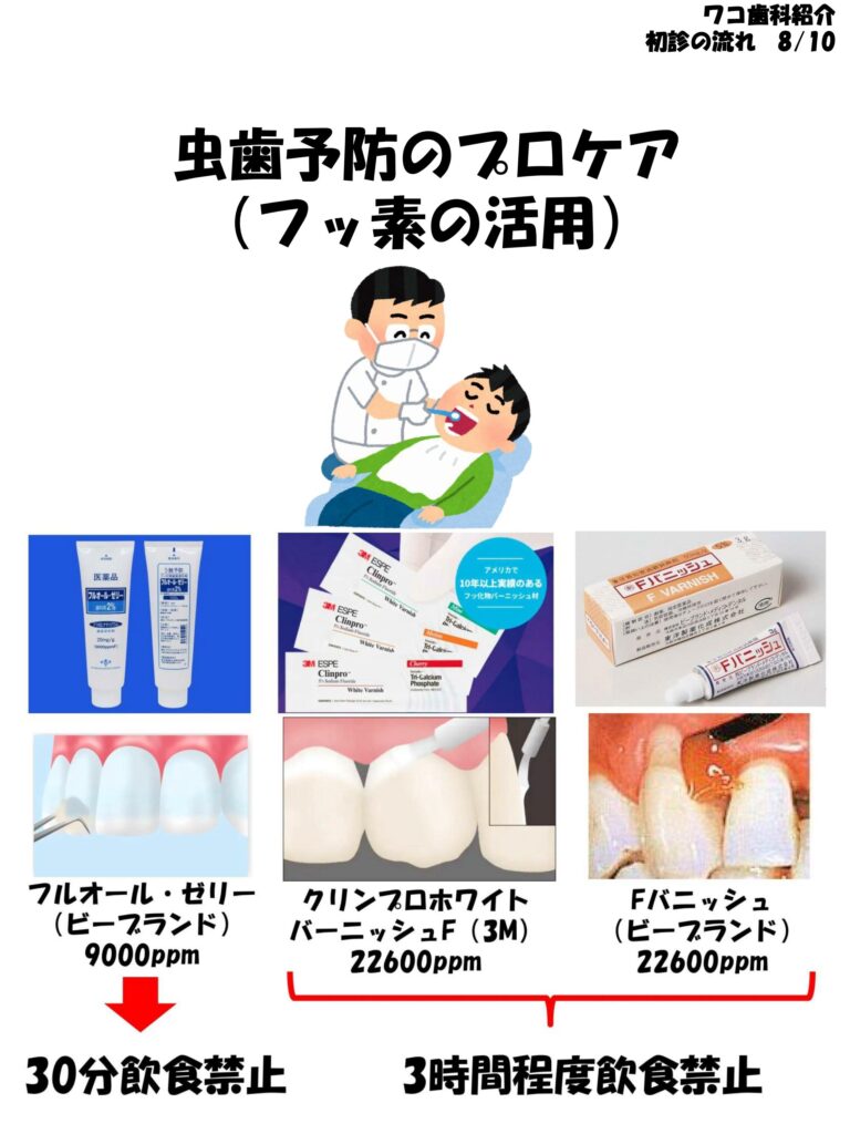 虫歯予防のプロケア